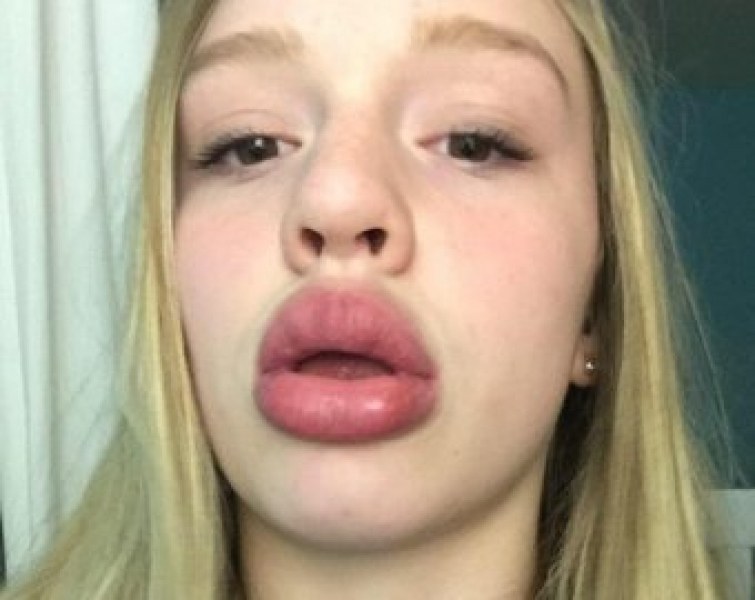 Момичета откриха прост, но не безопасен начин за уголемяване на устните! Струва ли си?