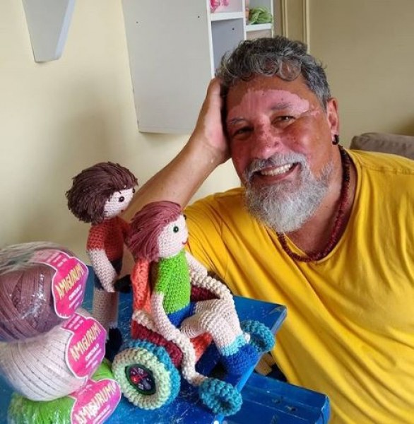Дядо плете кукли с витилиго! Различното послание към малките