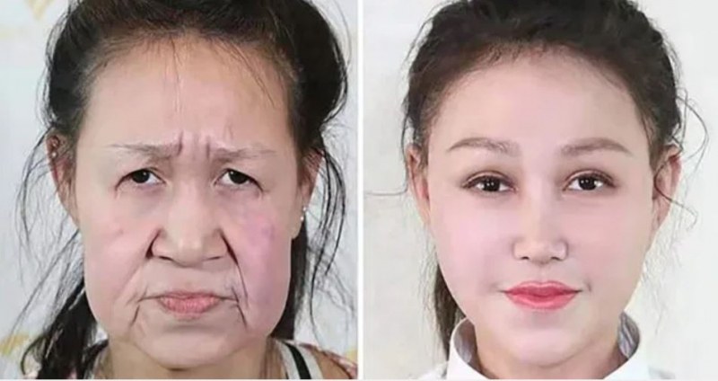 Тийнейджърка с вид на 60-годишна получи чисто ново лице! СНИМКИ+ВИДЕО
