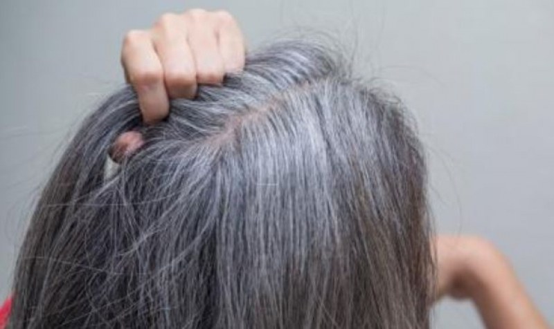 Потвърдено: Косата ни наистина може да побелее от стрес!