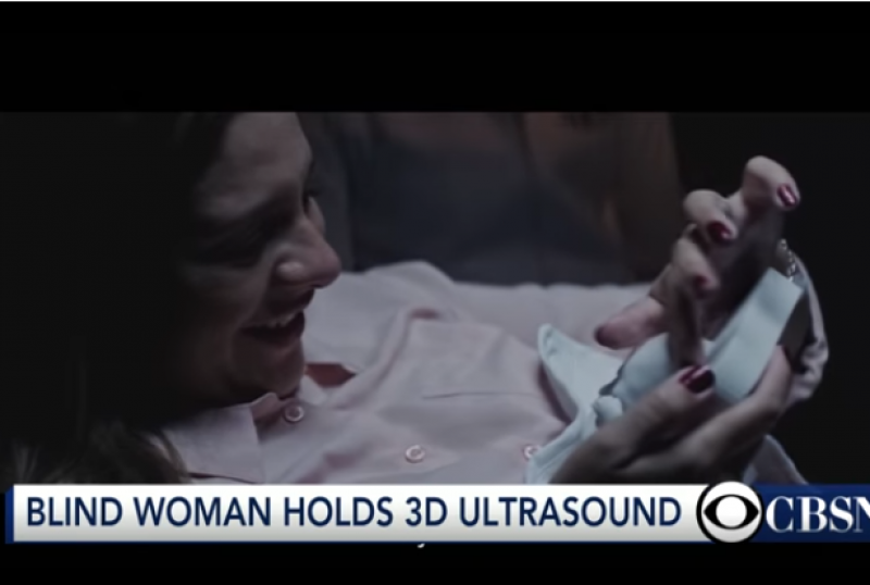 Красота: 3D ултразвук помага на сляпа майка да 