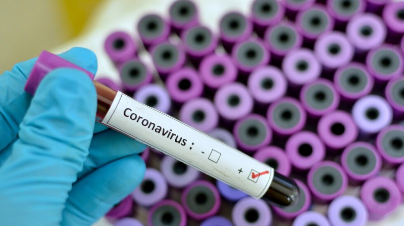 Украинец със съмнение за коронавирус е в наша болница