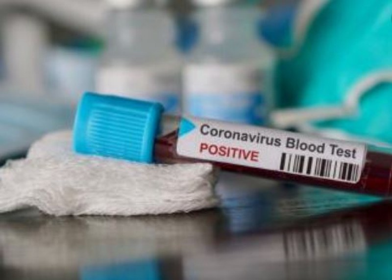 Още петима са дали положителни проби за коронавирус в Гърция