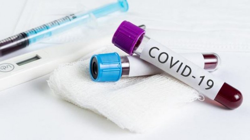 Частни лаборатории ще правят бързи тестове за COVID-19