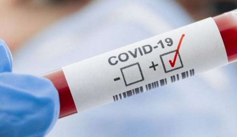 Ски учител е с положителна проба за COVID-19
