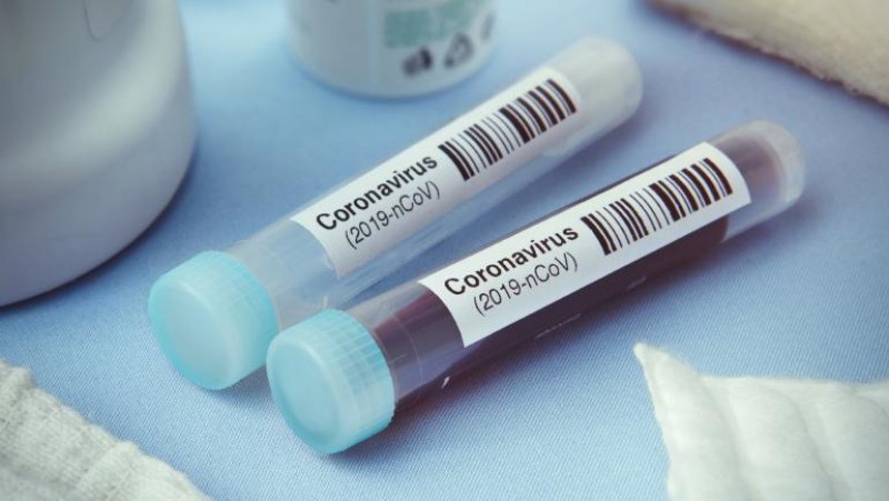 Откриха контактните лица на починалите майка и дъщеря от COVID-19 у нас