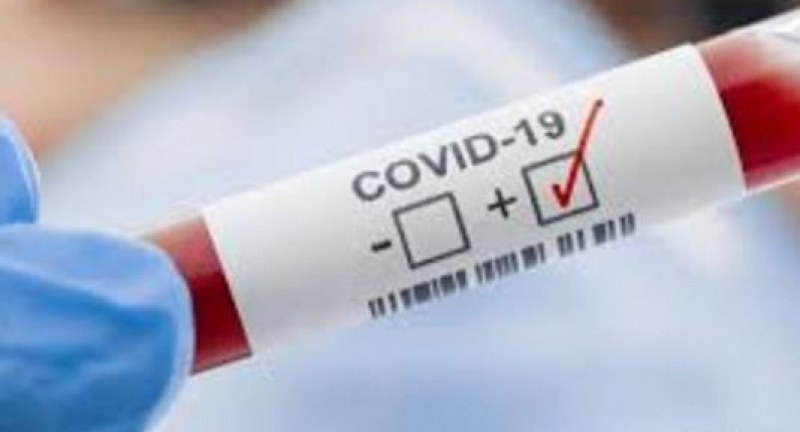 Жена с COVID-19 почина в наша болница!