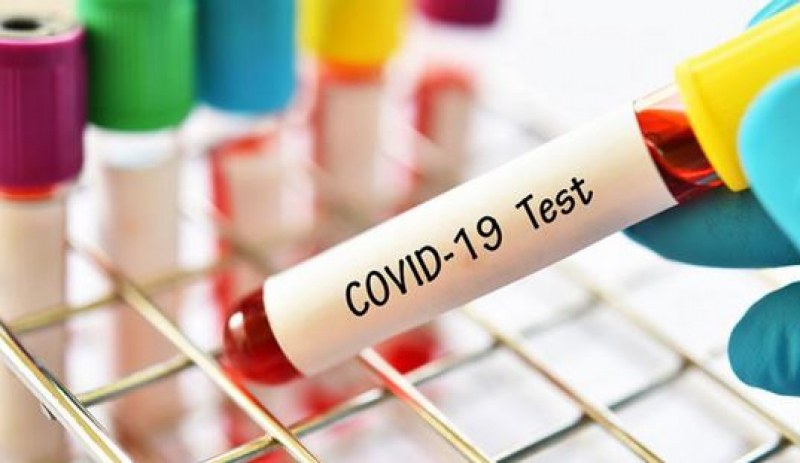 Мерките срещу COVID-19 може да продължат до 2022 година