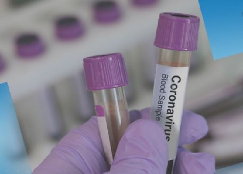 Затвориха шивашки цех заради заразени с COVID-19