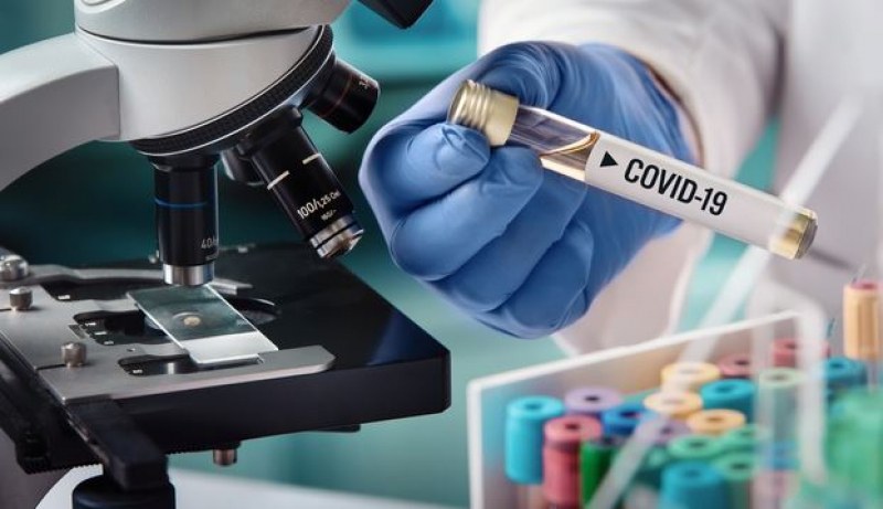 Стана ясно защо мъжете са по-застрашени от COVID-19