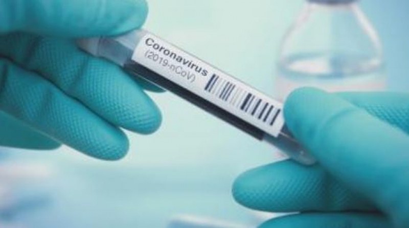 Преболедувалите COVID-19, дали положителна проба, не са повторно заразени