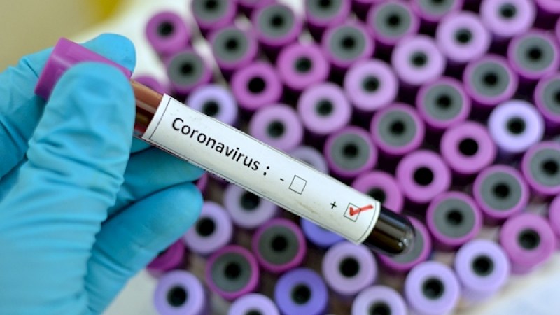 Затварят квартал в Перущица! 5 нови случая на COVID-19