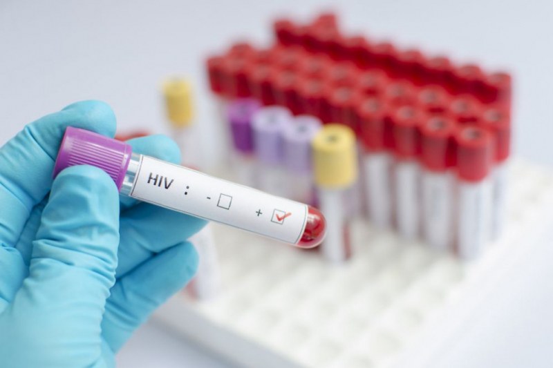 Откритие! 34-годишен мъж може да се окаже първият излекуван от ХИВ!