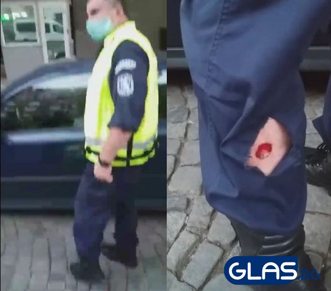 Кръв на протеста! Взриви се бомбичка в краката на полицай ВИДЕО 18+