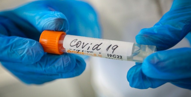 Кой ще бъде карантиниран, ако сме общували със заразен с COVID-19?