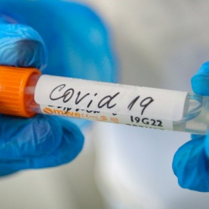 Кой ще бъде карантиниран, ако сме общували със заразен с COVID-19?