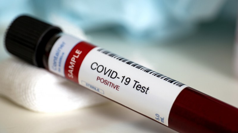 Кога се създават най-ефективни антитела срещу COVID-19