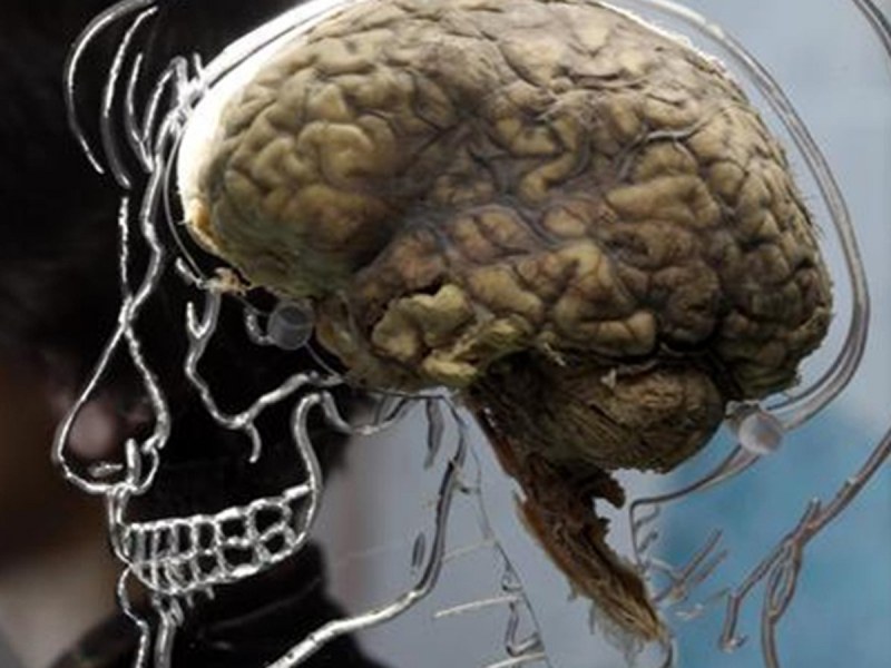 Разкриха мистерията на човешкия мозък