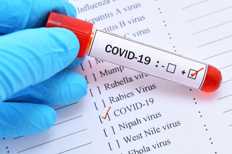 3 области раздуват COVID инфекцията. Повече излекувани, отколкото заразени