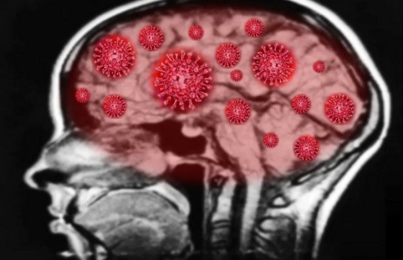 COVID-19 превзема мозъка, убива клетките. Учените: Инфекцията води до смърт!