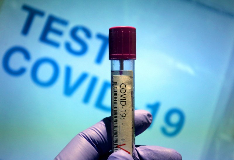 24-часова COVID картина: Стряскащ процент заразени спрямо тествани