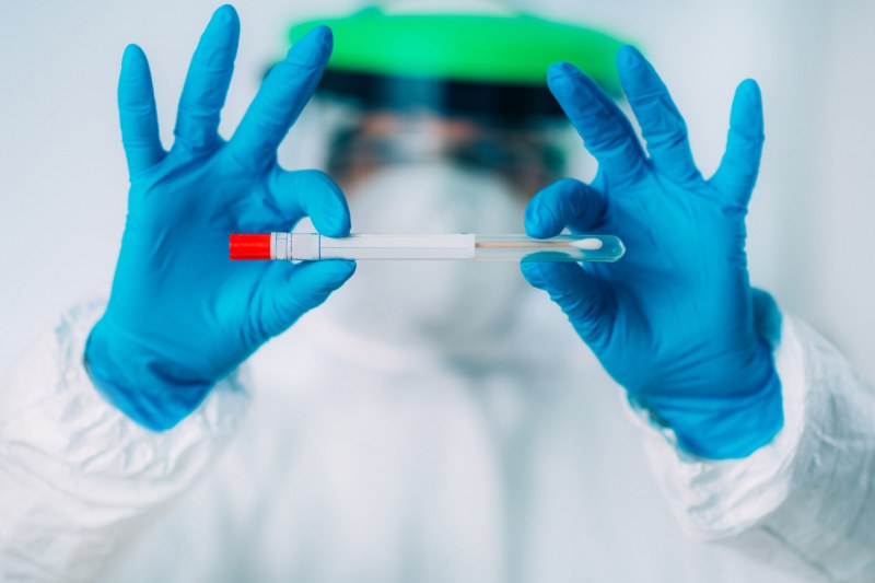 Скандални PCR-и! Лаборатория ги прави, но никъде не ги отчита