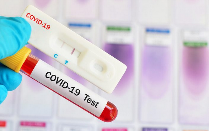 Китайска фирма създаде бърз тест, откриващ новия COVID щам