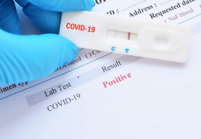 Учени: COVID-19 показва признаци на хронично заболяване