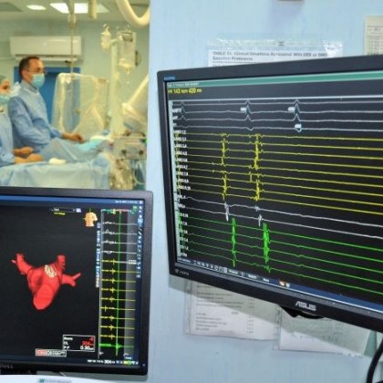 В УМБАЛ „Свети Георги" прилагат 3D навигация при премахване на аритмия