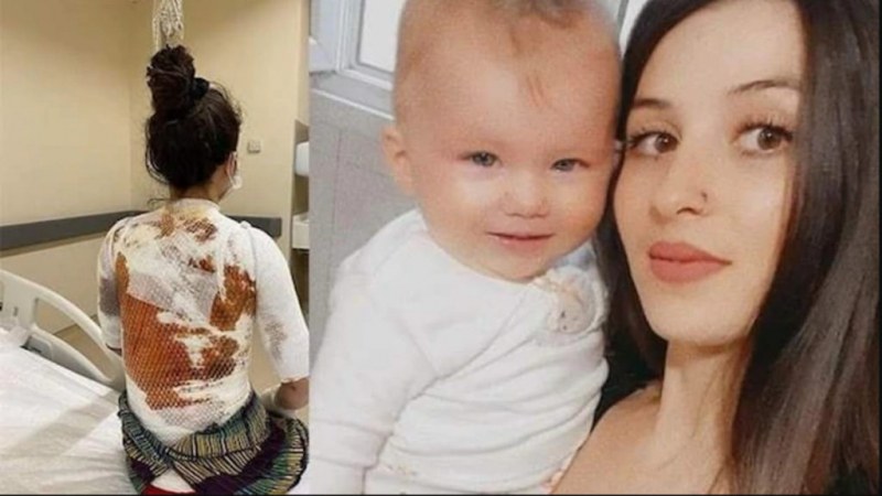 Мъж изля вряла вода върху жена си, защото... му занесла закуска в леглото СНИМКИ