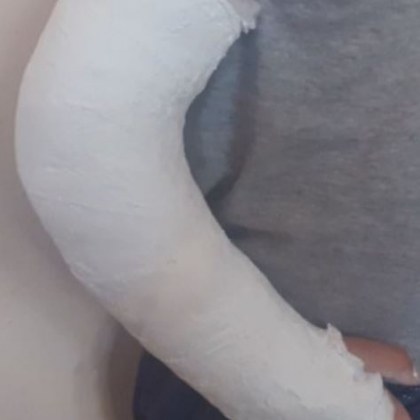 Екип на Спешна помощ отказа да прегледа дете със счупена ръка!