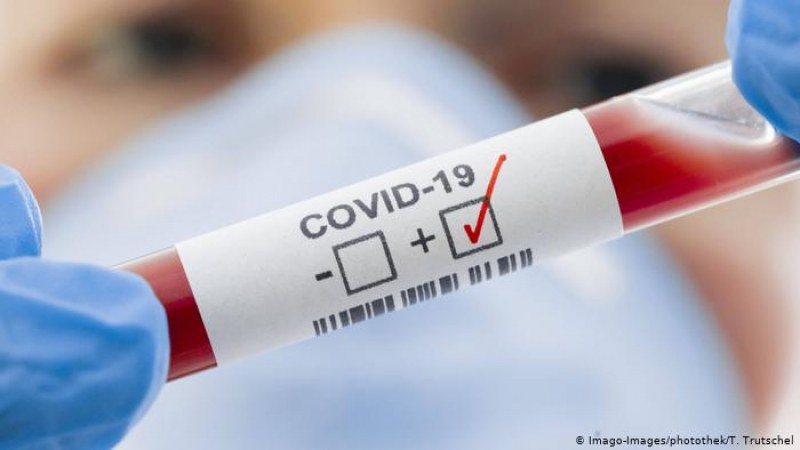 148 новозаразени с коронавирус у нас, положителни са 2,47% от изследваните