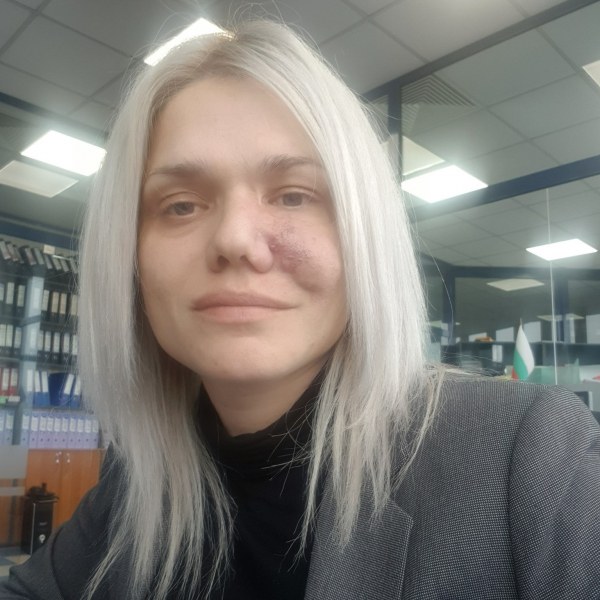 Жена от Пловдив се нуждае от животоспасяваща интервенция
