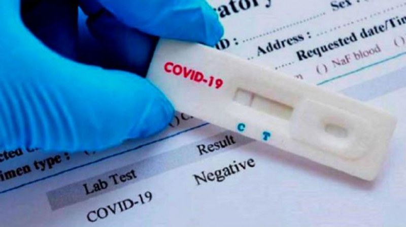 Разкриха измама с PCR тестове за пътуващи към Турция