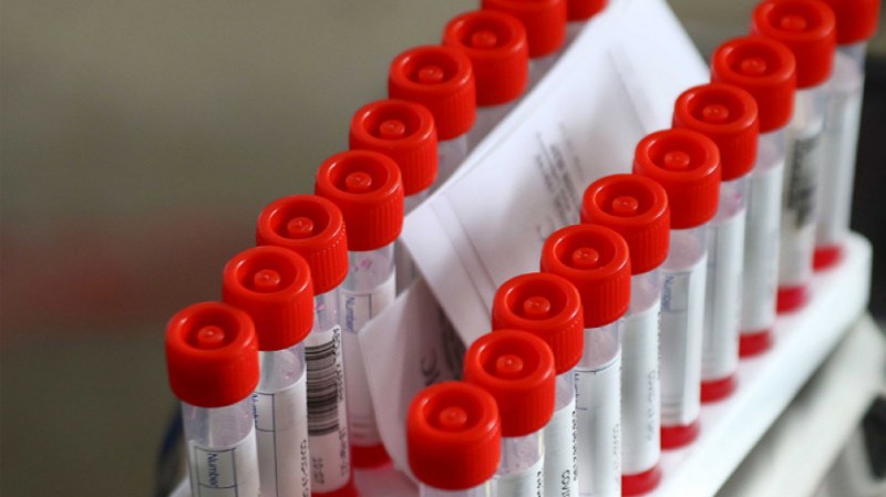 За отрезвяване от вота: 276 жертви на вируса, над 3% от тях – ваксинирани