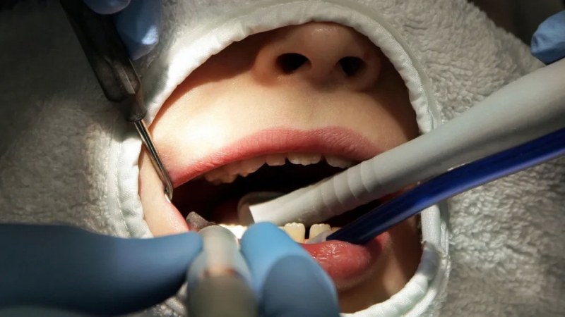 Смърт на стоматологичния стол: Кой е отговорен за смъртта на 4-годишната Емилия?
