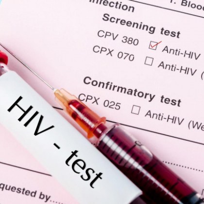 Установен е нов вариант на ХИВ който е по вирулентен