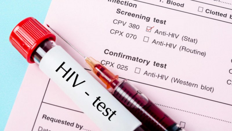 Установен е нов вариант на ХИВ – агресивен е, предава се и по-лесно