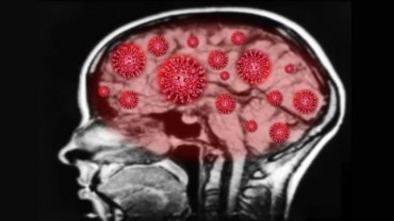 Дефекти на мозъка като при Алцхаймер: Откриха аномалия в преболедувалите ковид