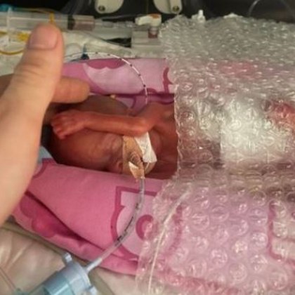 Млада двойка станаха родители на най малкото недоносено бебе във Великобритания Те