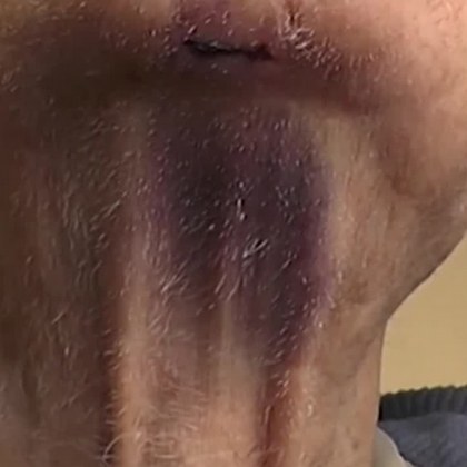 Рецидивисти пребиха и посиниха дядо, обраха му 280-те левчета ВИДЕО