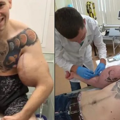 Руският Попай се подложи на нова операция. Иска да прилича на извънземно! СНИМКИ