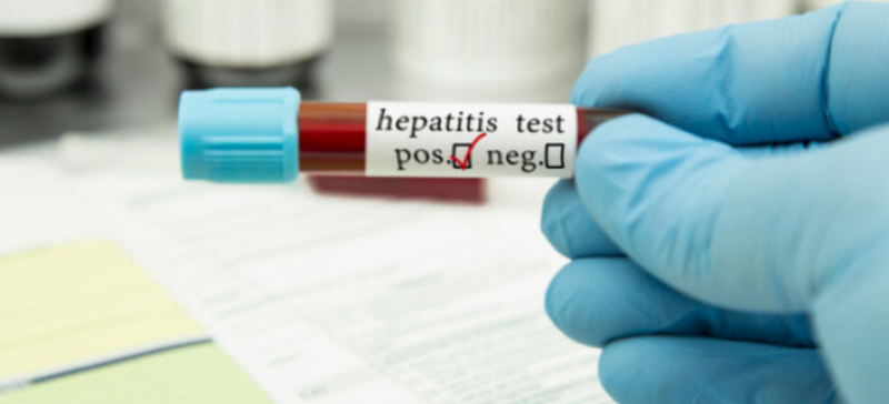 Нов вид хепатит, който разболява сериозно деца, притесни здравните власти.