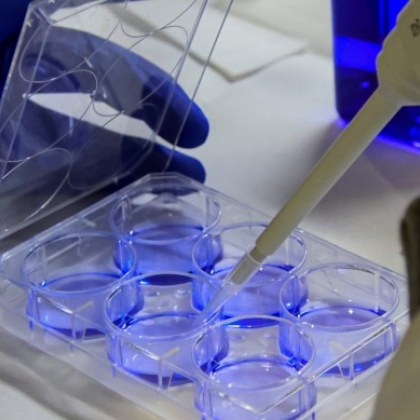 Нови 37 случаи на маймунска шарка са регистрирани във Великобритания