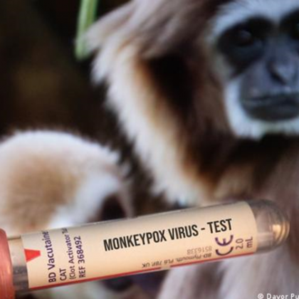 Масови тестове за маймунска шарка започват болниците в Мадрид от