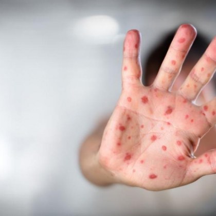 От Националния център по заразни и паразитни болести публикуваха на