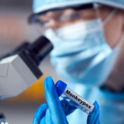 В Турция е регистриран първи случай на маймунска шарка съобщи