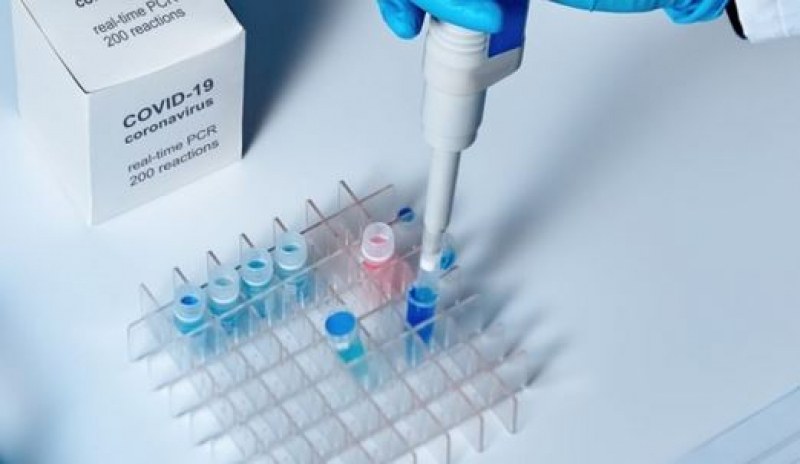 Разработиха тест, проследяващ нивото на антитела срещу разновидностите на вируса