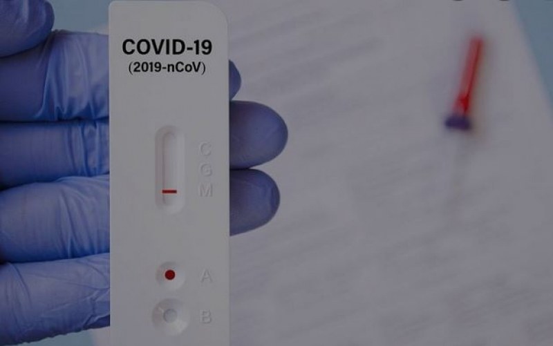 Министерство на здравеопазването предлага бързите антигенни тестове за коронавирус да