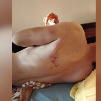 Млад мъж се оплака от полицейско насилие